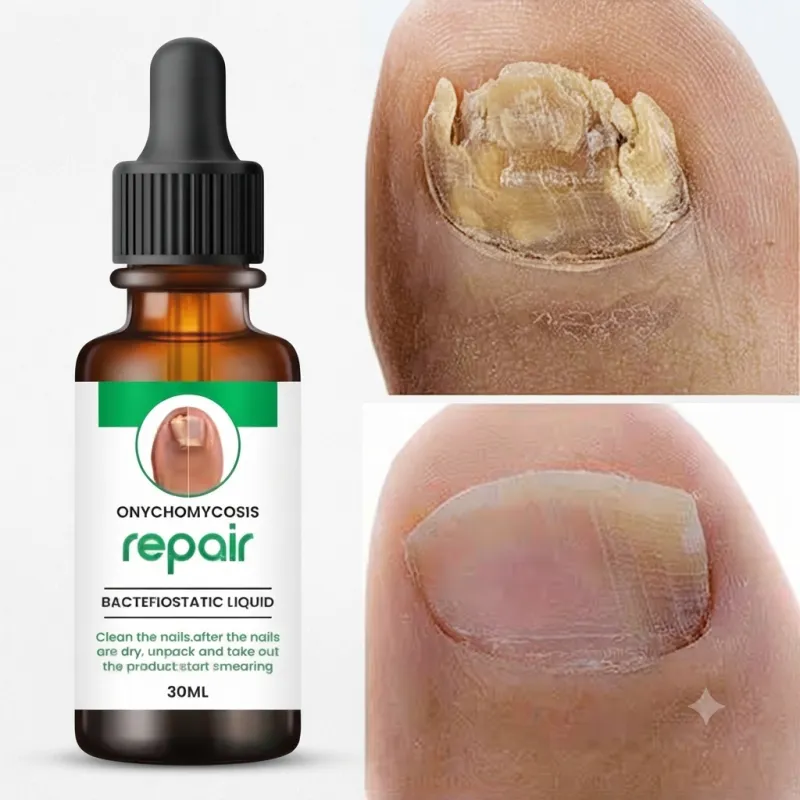 KORAT KING Nail Oil for Nail Growth & Cuticle Repair